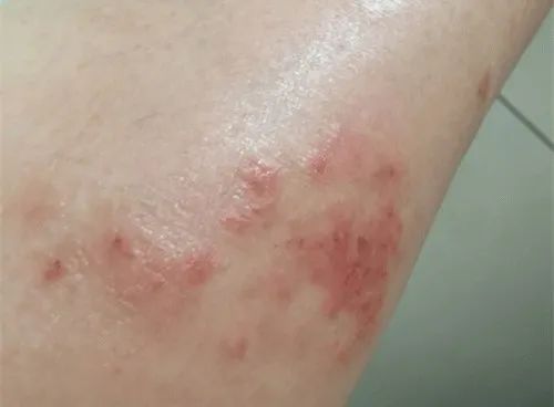护肌堂止痒膏