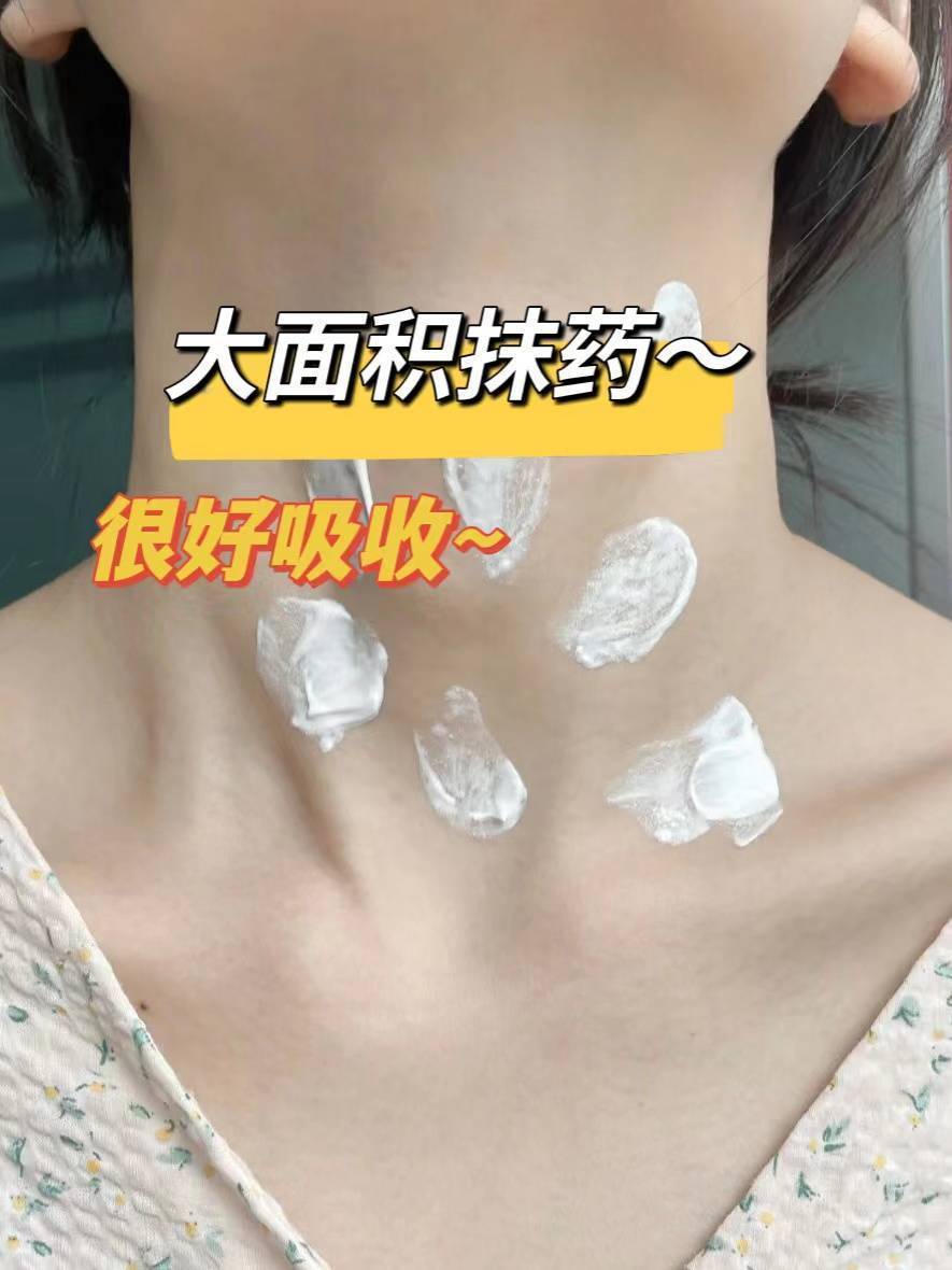 过来人亲测！超厉害的湿疹止痒法！我不允许湿疹止痒法折磨任何人！